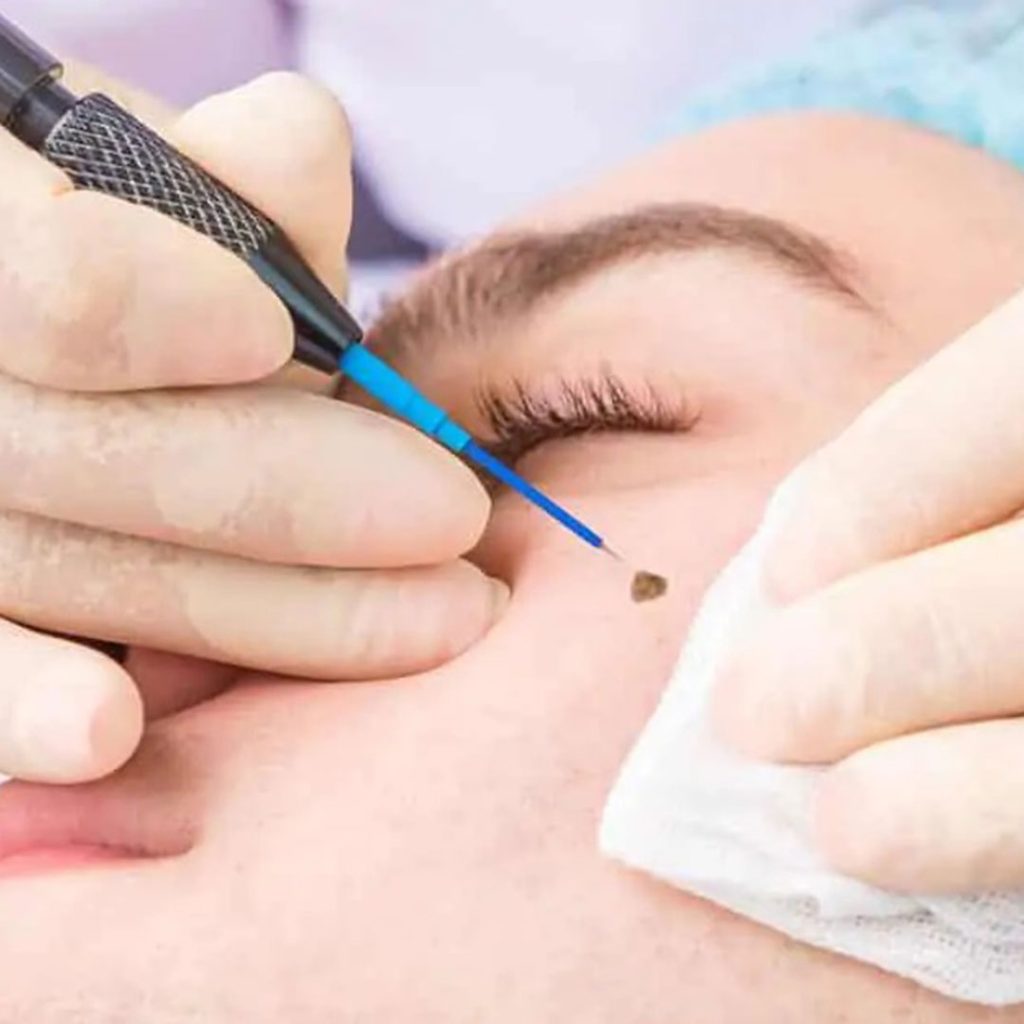 Reconstructive surgery and scar revision